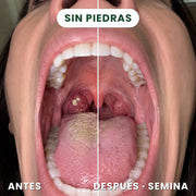 Semina™ Defensa Oral para el Aliento