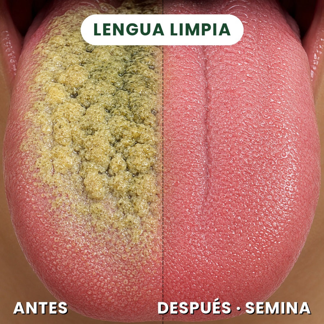 Antes y despues: placa en la lengua