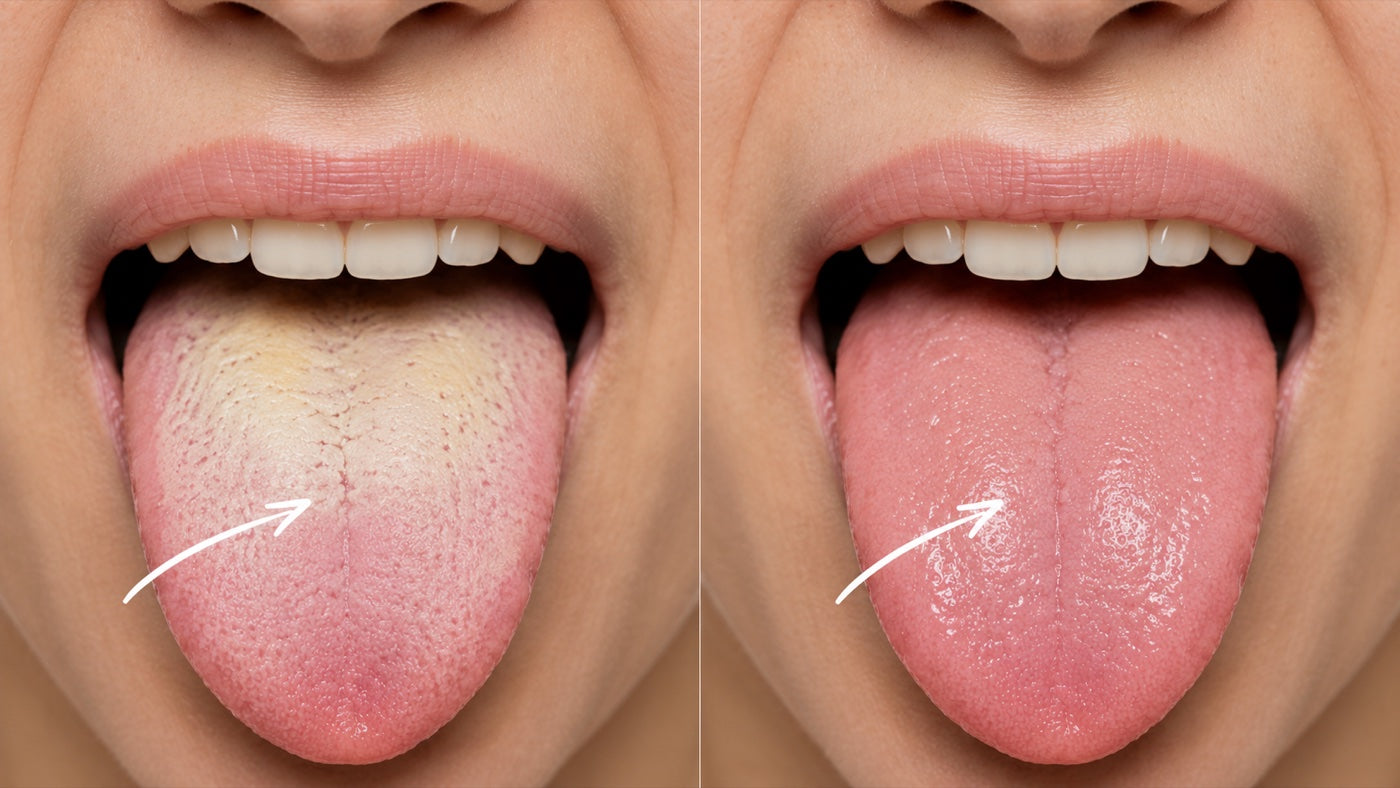 Antes y después: lengua con capa blanca vs lengua limpia y rosada